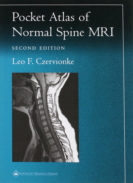 Pocket Atlas of Spinal MRI (Radiology Pocket Atlas Series) - 3893