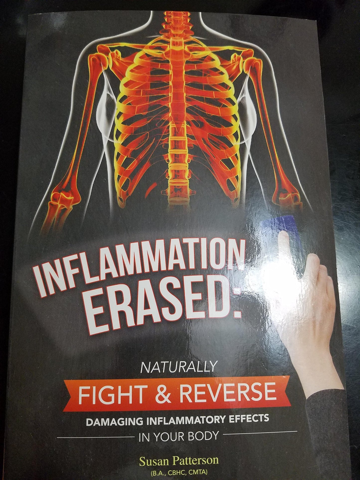 Inflammation Erased - 5465