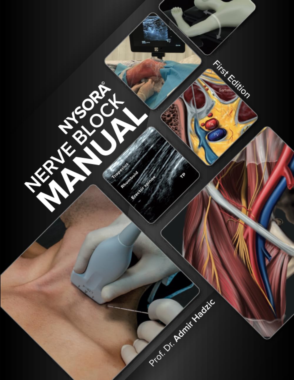 NYSORA Nerve Block Manual: First Edition - 648