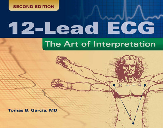 12-Lead ECG: The Art of Interpretation: . (Garcia, Introduction to 12-Lead ECG) - 6021