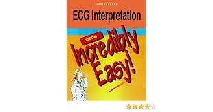 ECG Interpretation Made Incredibly Easy - 150