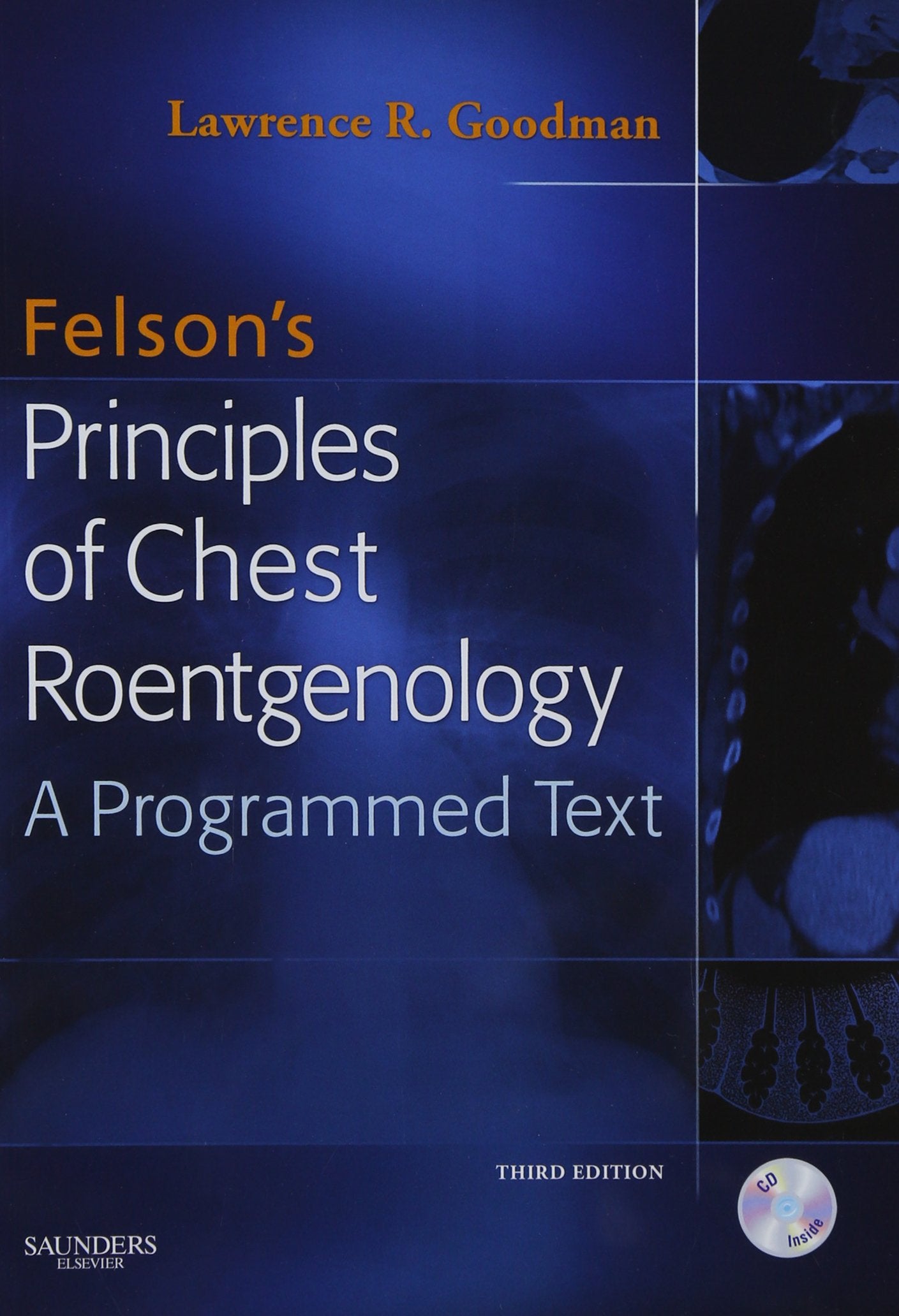 Felson's Principles of Chest Roentgenology Text with CD-ROM - 211