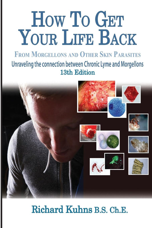 How to Get Your Life Back From Morgellons and Other Skin Parasites Limited Edit - 5375