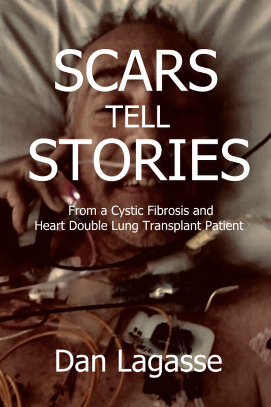 Scars Tell Stories: From a Cystic Fibrosis and Heart/Double Lung Transplant Patient - 3943