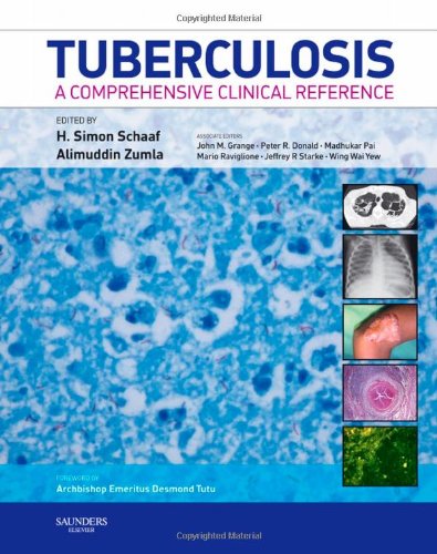 Tuberculosis: A Comprehensive Clinical Reference - 4724